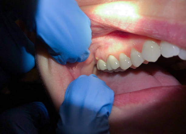 Best 24-Hour Emergency Dentist in Plumsteadville, PA