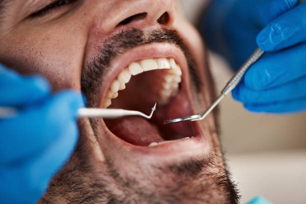 Best Cosmetic Emergency Dentistry in Plumsteadville, PA
